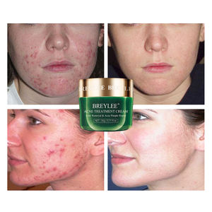 BREYLEE <span class=keywords><strong>Tea</strong></span> <span class=keywords><strong>tree</strong></span> acné supprimer boutons traitement à base de plantes crème pour l'acné - Product Image 4
