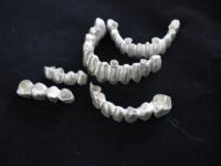 Imprimante 3D métallique SLM PRS-M100 pour laboratoire dentaire, prix distributeur, peu encombrante