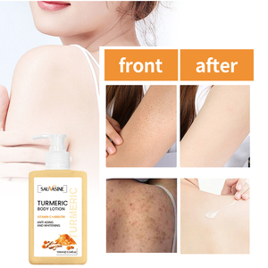 Oem and Private Label Service GMPC Approved Moisturizing and Nourishing Turmeric Body Lotion - Product Image 4