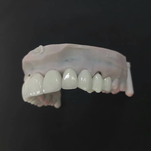 Buen <span class=keywords><strong>Precio</strong></span> Chapa Dientes Restauración <span class=keywords><strong>de</strong></span> porcelana Blanqueamiento dental Preparación mínima Carillas <span class=keywords><strong>dentales</strong></span> - Product Image 1