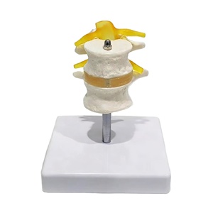Modèle de colonne lombaire à deux segments avec disque fonctionnel, spécimen de <span class=keywords><strong>test</strong></span> biomecanique L3-L4 L4-L5, aide pédagogique médicale - Product Image 1