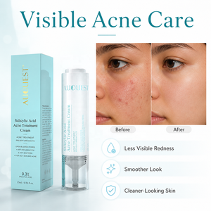 Crema OEM per il trattamento dell'acne con acido salicilico al 0,3%, riduce i punti neri e l'acne del <span class=keywords><strong>viso</strong></span>, controlla e elimina le imperfezioni. - Product Image 2