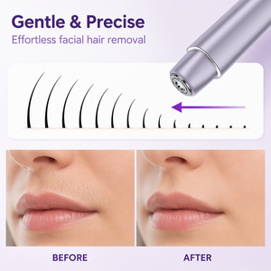 Electric Facial <strong>Hair</strong> <strong>Remover</strong> for Women USB Rechargeable Portable <strong>Face</strong> Shaver for Upper/lip/chin/peach Fuzz Facial <strong>Hair</strong> Removal - Product Image 3