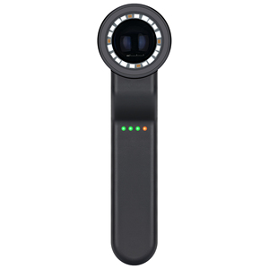 <span class=keywords><strong>Dermatoscope</strong></span> IBOOLO DE-4100 PRO avec lumière UV 365 nm, le meilleur <span class=keywords><strong>dermatoscope</strong></span> au monde - Product Image 4