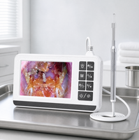 Otoscope numérique portable avec écran, caméra d'oreille, outil de nettoyage de cérumen et endoscope pour le nettoyage quotidien