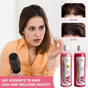 Private Label Onion Biotin and Rosemary <strong>Shampoo</strong> Treatment Set for Moisturizer Stronger Thicker Soft Shine Hair Growth <strong>Shampoos</strong> - Product Image 4