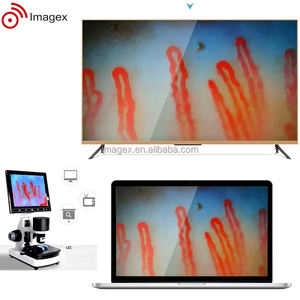 Instrument optique de capillaroscopie de la pliure unguéale pour le diagnostic en rhumatologie et le dépistage des maladies auto-immunes - Product Image 3