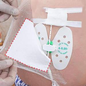 Thiết bị ổn định tiên tiến của Universal <span class=keywords><strong>Plus</strong></span> Medical Consumables - Product Image 2