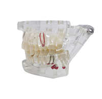 Modelo de Resina Desmontable para Implantes Dentales y Dientes Patológicos, Demostración de Cuidado Bucal y Puentes y Coronas de PVC para Ciencia Médica CE