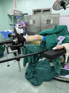 Ортопедическая рама для тяги из углеродного волокна в качестве заменяемого Хирургического Стола для замены бедер или стола для тяги при переломе ног - Product Image 6