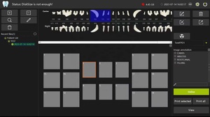 Sensore a raggi X dentale di vendita calda Pluto0001X/0002X Rvg sensore a raggi X dentale digitale digitale USB sensore dentale RVG digitale originale - Product Image 5