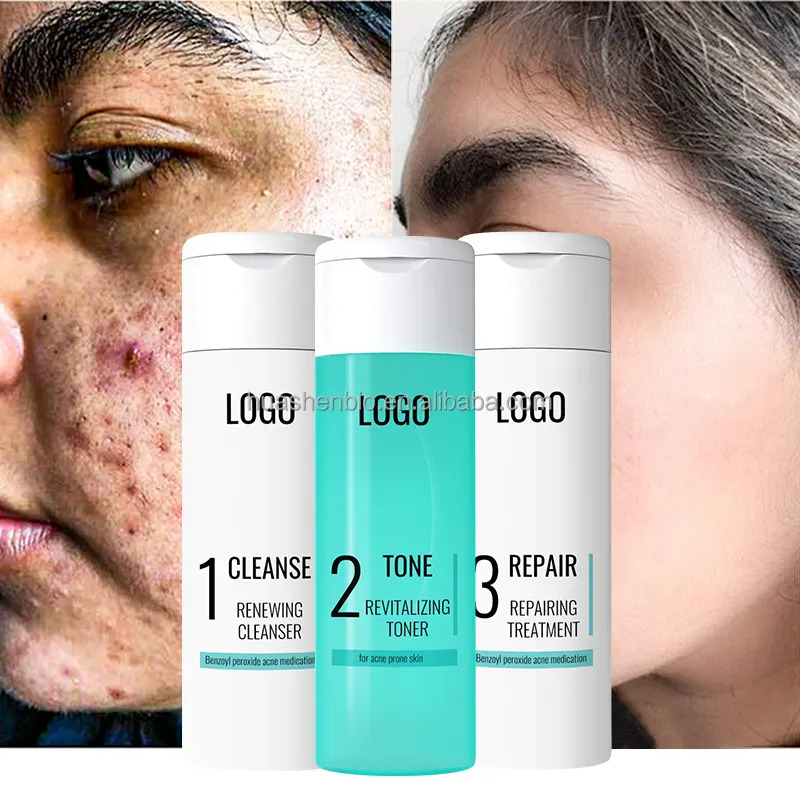 Private Label Skincare Anti Acne Treatment Oil Control Facial Cleanser Moisturizer Acne Cream Toner Vegan Facial Skin Care Set
