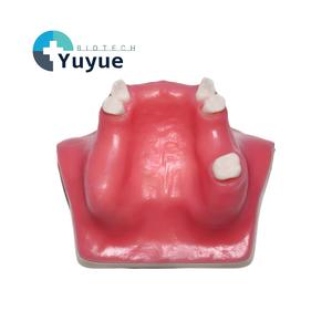 Modelo de Entrenamiento para Levantamiento de Seno Maxilar - Modelo de Práctica de Seno Maxilar Tipo C para Educación Dental - Product Image 1
