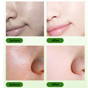 ZS Serum Chlorophyll kulit, terapi peremajaan Vitamin C kolagen penghilang keriput perbaikan kulit Chlorophyll - Product Image 6