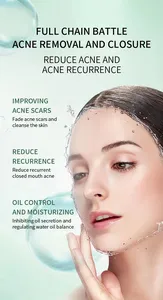 Support Small Order Customization Wholesale Acne Application Mud Masque To Clean Pores Blackheads Lifting