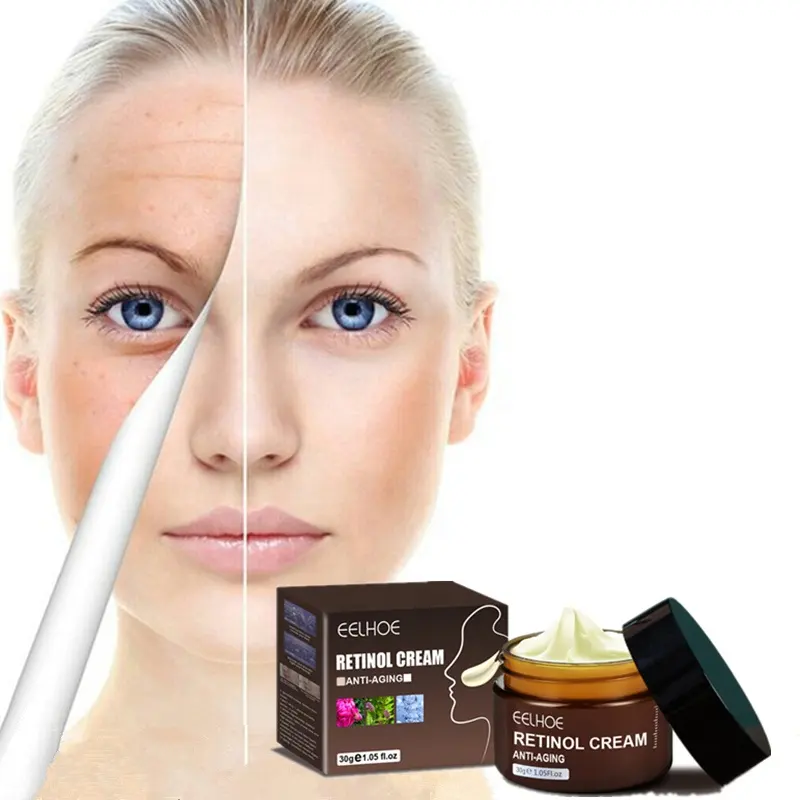 Eelhoe 30g chống lão hóa Retinol Kem dưỡng ẩm làm sáng da Kem chăm sóc loại bỏ nếp nhăn chống lão hóa