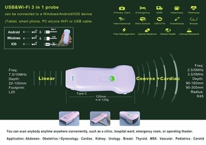 เครื่องอัลตราซาวนด์ไร้สายแบบพกพา พร้อมหัวตรวจแบบ Convex และ Linear รุ่น M221 สำหรับ P - Product Image 4
