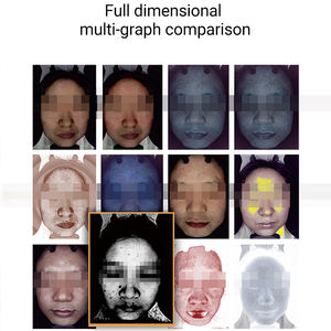 Nouvel analyseur de peau IA amélioré, équipement de beauté pour les soins de la peau, <span class=keywords><strong>dermatologie</strong></span>, analyse de la peau 3D, appareil d'imagerie intelligent Moji Al, 15,6 pouces - Product Image 4