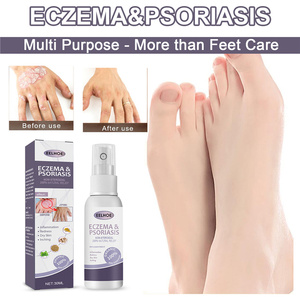 Eelhoe Spray de 30 ml para <span class=keywords><strong>Eczema</strong></span> y Psoriasis, Inflamación de la Piel, Enrojecimiento, Picazón, Tratamiento Líquido para Psoriasis, <span class=keywords><strong>Eczema</strong></span> y Dermatitis - Product Image 1