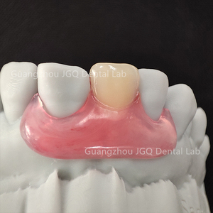 Dentiers amovibles Valplast, prix du laboratoire dentaire en Chine, dentiers flexibles en acrylique, dentiers amovibles RPD avec dents artificielles en acrylique - Product Image 4