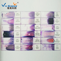 Hematology Prepared Slides Blood Smear Microscope Slide Handmade From Glass