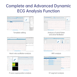 Moniteur ECG portable, appareil d'électrocardiogramme, analyse, systèmes d'ECG dynamiques, enregistreur, ECG Holter 12 canaux - Product Image 5