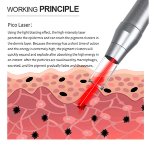 ราคาขายส่งใหม่ เครื่องเลเซอร์พิโกวินาที 6 หัวเลือกได้ สำหรับลบรอยสัก พร้อมหัวแบบไม่รุกล้ำ - Product Image 5