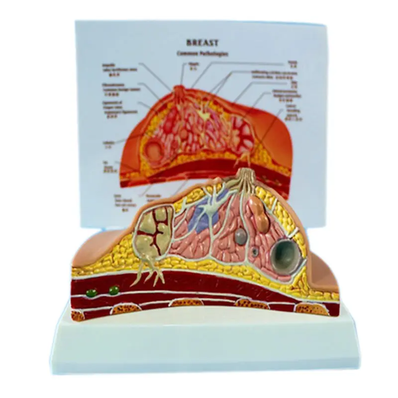 유방 병리학 해부학 모델 간호 실습 모델 유방 해부학 모델