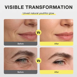 Özel Marka Retinol <span class=keywords><strong>Serum</strong></span> Kremi Cilt Bakım Vücut Losyonu Shot Yüz Kolajen Esansı Besleyici Onarıcı Aydınlatıcı Kırışıklık Karşıtı - Product Image 6
