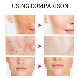 Crema Facial de Baba de <span class=keywords><strong>Caracol</strong></span> para el Cuidado de la Piel, Crema Reparadora de Marca Privada, Crema Hidratante Nutritiva y Suavizante, Crema Facial para el Cuidado de la Piel con 92% de Baba de <span class=keywords><strong>Caracol</strong></span> - Product Image 4
