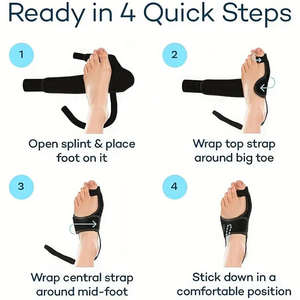 สายรัดสำหรับแก้ไขกระดูกและข้อที่ใช้ในเวลากลางวัน2025การยืดกระดูกที่ใช้ที่รัดข้อต่อตาปลา - Product Image 6