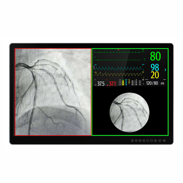 31.5\" 4K Medical Grade IPS LCD Monitor for Desktop Anti-Glare Glass Panel Accurate Color Reproduction for Endoscopy Surgery