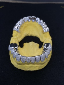 Rejilla Dental Personalizada de Hip Hop, con Incrustaciones de Plata 925 y Moissanita VVS, Corte Permanente 12x12, para Hombres - Product Image 2