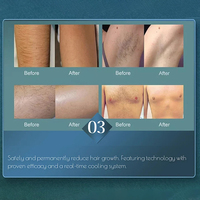 Máquina de depilación láser para cara y cuerpo, diodo, salón, Spa, dispositivo estético, instrumento de belleza depilatorio