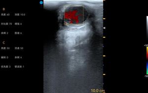 Bmv Draagbare Doppler Kleur Runderen Echografie Machine Dier Palm Echografie - Product Image 5