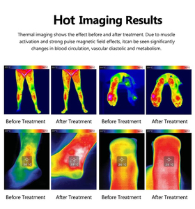 Máquina Avanzada para el Alivio del Dolor, Especializada en Dolor de Espalda, Lumbar, Hombro, Reumatismo, Tenosinovitis, Dolor de Talón, Dispositivo para Salón y Clínica - Product Image 5