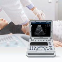 Échographe cardiaque portable 3D/4D CONTEC CMS1700B