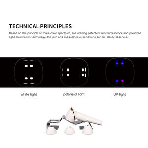 Ai頭皮テスト脱毛防止育毛装置電気頭皮髪と頭皮分析機 - Product Image 5