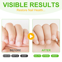Soin des ongles de marque privée, stylo sérum pour arrêter de se ronger les ongles, liquide naturel et amer de longue durée pour enfants
