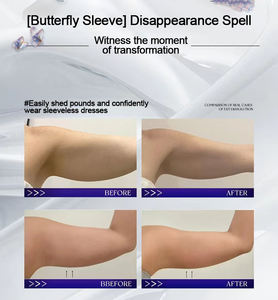 Máquina de Rejuvenecimiento Cutáneo Vertical Pro Coldwave al Mejor Precio, para Lifting Facial y Pérdida de Peso Corporal - Product Image 4