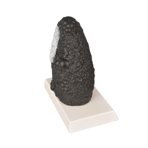 Modelo <span class=keywords><strong>de</strong></span> pulmón <span class=keywords><strong>de</strong></span> <span class=keywords><strong>fumador</strong></span> grande en silicona (23x12x9cm 1,7625 kg) Vs Modelo <span class=keywords><strong>de</strong></span> pulmón normal en silicona-Anatomía duradera y realista - Product Image 6