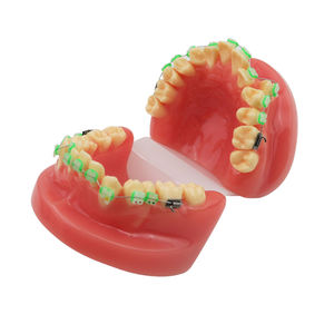 Modelo de Demostración de Ortodoncia para Educación Dental con 28 Piezas de Dientes y Brackets de Cerámica - Product Image 3