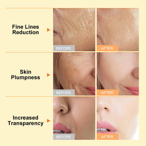 Crème pour le visage anti-âge, anti-rides, liftante et raffermissante, avec logo personnalisé OEM ODM, collagène, rétinol, <span class=keywords><strong>aloe</strong></span> vera, acide hyaluronique, vitamine C - Product Image 3