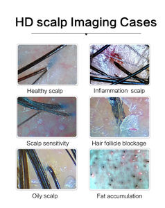 OEM ve ODM yüksek kalite taşınabilir Hd ekran solmuş saç dökülmesi dedektörü saç derisi tarayıcı saç analizörü/cilt ve saç analizi - Product Image 3