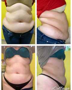 635nm-650nm amincissant la machine plus 160mw lipolasers <span class=keywords><strong>prix</strong></span>/Lipo Lasers tampons Machine 980nm lipolyse combustion des graisses perte de poids - Product Image 4