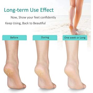 Factory Latest Portable Foot File Pedicure Tool <strong>Hands</strong> Feet Exfoliating Artifact Glass Sanding Stone <strong>Callus</strong> <strong>Remover</strong> - Product Image 3
