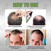 Minyak Serum Perawatan Rambut Rosemary Penumbuh Rambut Langsung dari Pabrik, Efek Terbaik, Semprotan Penumbuh Rambut 60ml