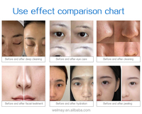 Le plus récent jet d'oxygène Peel Machine de soins de la peau Oxygen Water Jet Peel Facial Machine Hydrodermabrasion Oxygen Facial Equipment