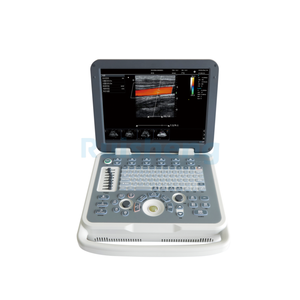 Système d'échographie portable professionnel RS-N30, meilleur appareil d'échographie portable de Chine, scanner couleur <span class=keywords><strong>Doppler</strong></span> - Product Image 3