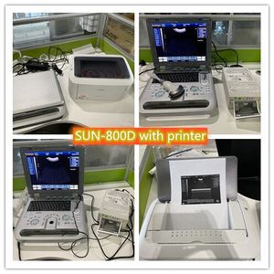 Kwaliteit Ultrasone Machines Pc-gebaseerde <span class=keywords><strong>Laptop</strong></span> Medische 15 "Scherm Zwart En Wit 3D Software <span class=keywords><strong>Ultrasound</strong></span>